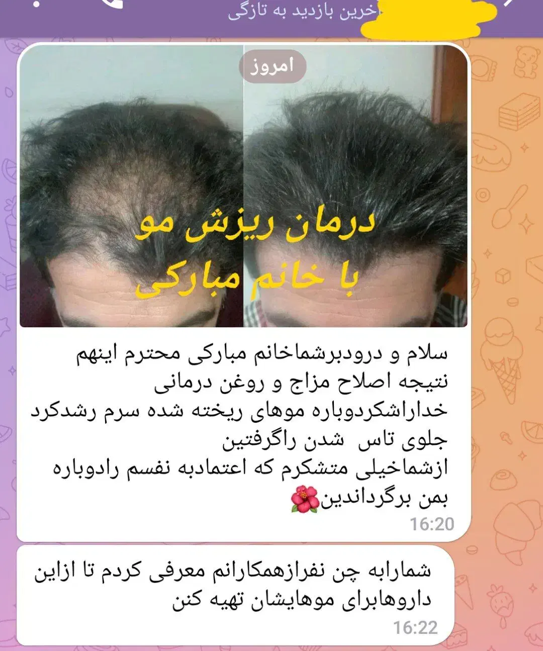 پوست و مو|آرایشی، بهداشتی، درمانی|آستانه اشرفیه, |دیوار