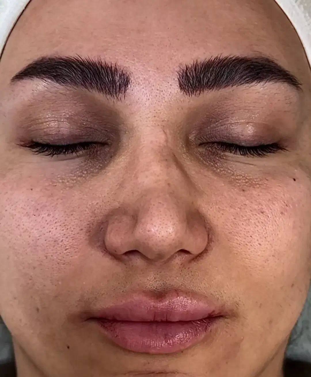 فیشال و(پاکسازی پوست)آبرسانی پوست|خدمات آرایشگری و زیبایی|رفسنجان, |دیوار