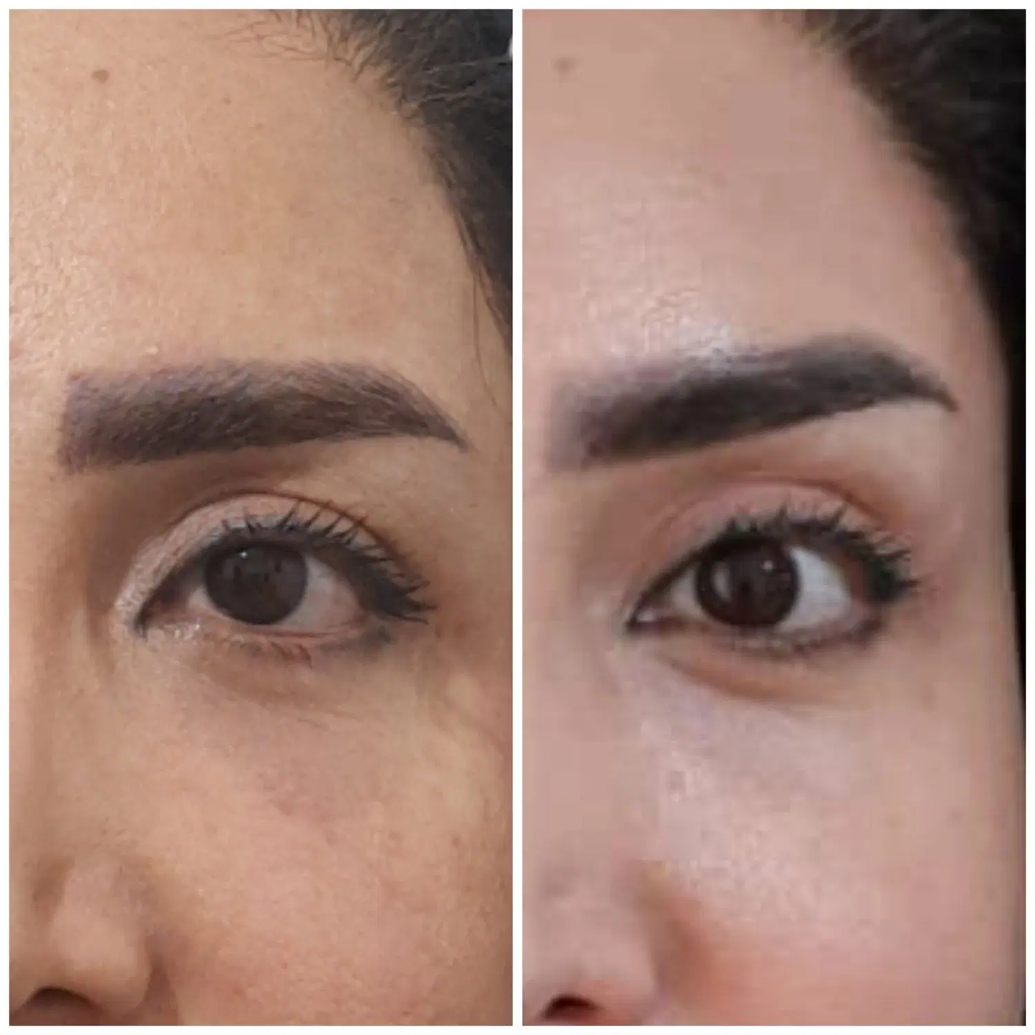 بوتاکس|خدمات آرایشگری و زیبایی|سنقر, |دیوار