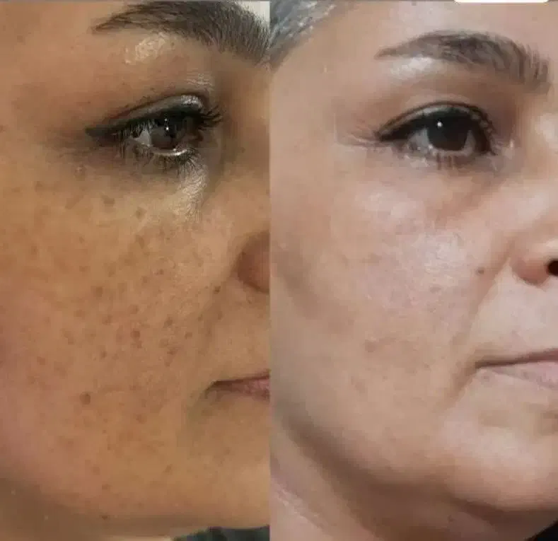 پاکسازی بدن و لاغری|آرایشی، بهداشتی، درمانی|یزد, |دیوار