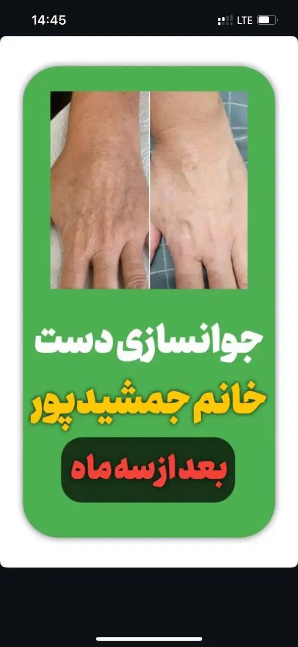 نمایندگی رسمی گاتیو کرم بوتاکس پنج کاره|آرایشی، بهداشتی، درمانی|قم, یزدان‌شهر|دیوار