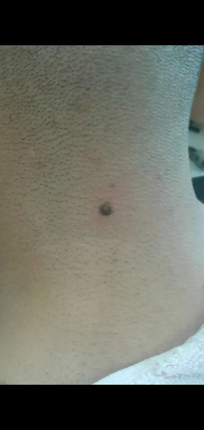 خال برداری|خدمات آرایشگری و زیبایی|ورامین, ورامین|دیوار