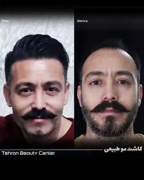 تور خدمات و جراحی زیبایی|خدمات آرایشگری و زیبایی|گرگان, |دیوار