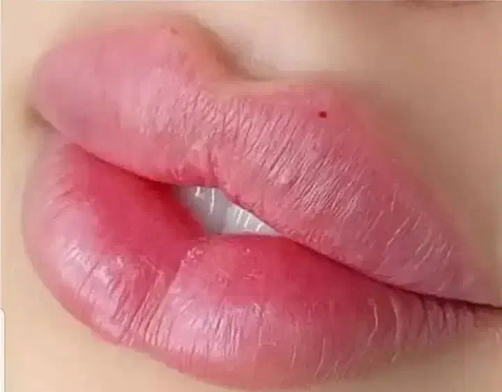 ژل بوتاکس گلوتاتیون سفید کننده بمدت ۳ روز خاش|خدمات آرایشگری و زیبایی|خاش, |دیوار