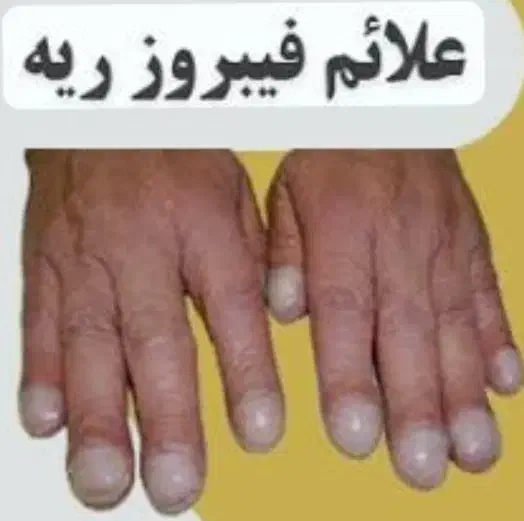 مشاوره طب سنتی برای مشکلات تنفسی|خدمات آرایشگری و زیبایی|رفسنجان, |دیوار