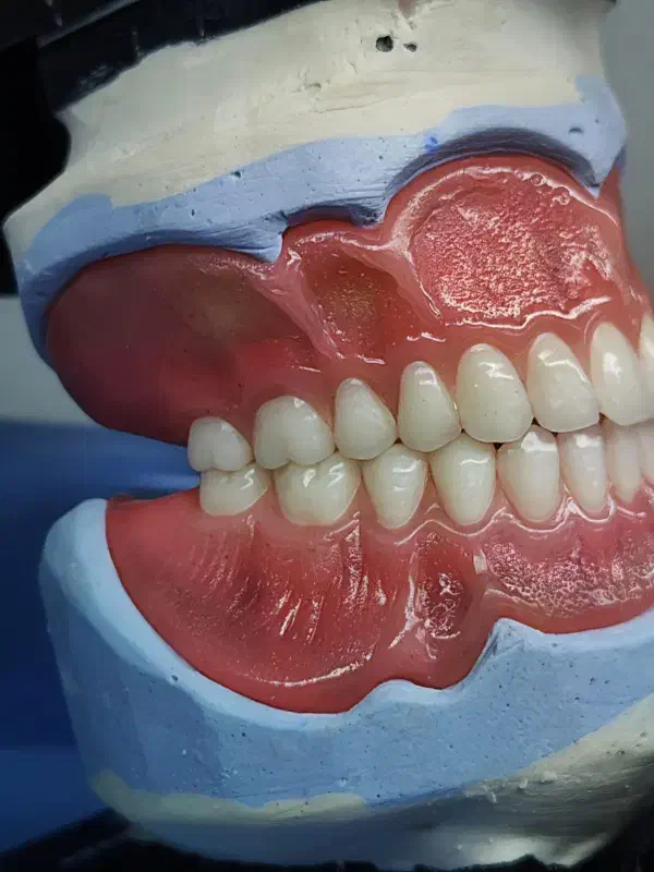 دندان مصنوعی ایتالیایی|آرایشی، بهداشتی، درمانی|چناران, |دیوار