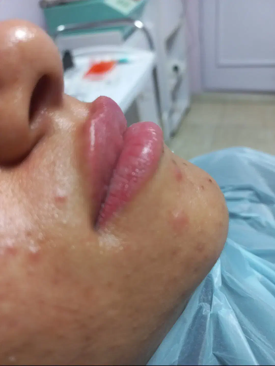 تزریق ژل و بوتاکس و prp صورت و مزو مو|خدمات آرایشگری و زیبایی|سبزوار, جوادیه شرقی|دیوار