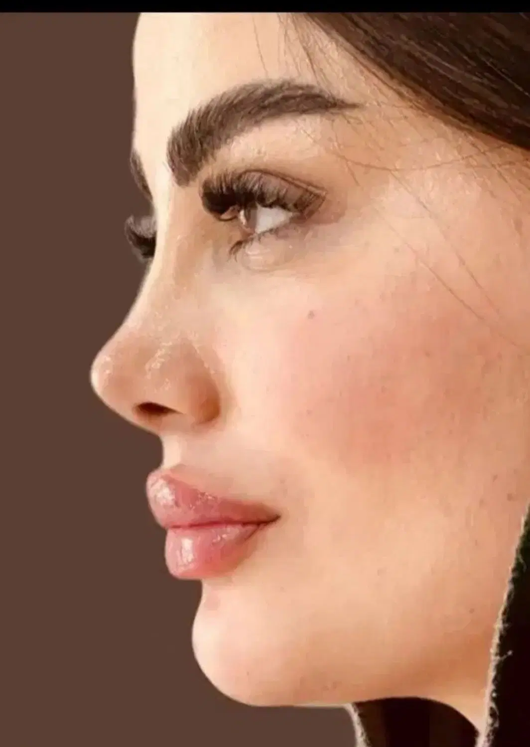 لیفت صورت ،شقیقه،گونه ،جراحی بینی ،تخفیف تابستان|خدمات زیبایی و سلامت|تهران, ونک|دیوار