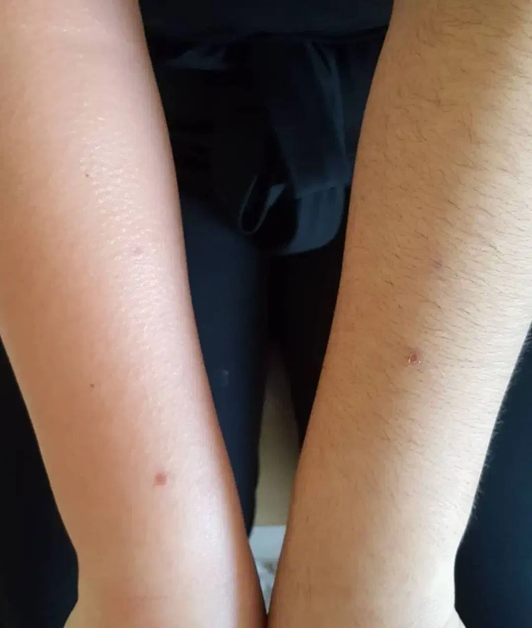 اپیلاسیون|خدمات آرایشگری و زیبایی|نیشابور, شهرک ولیعصر|دیوار