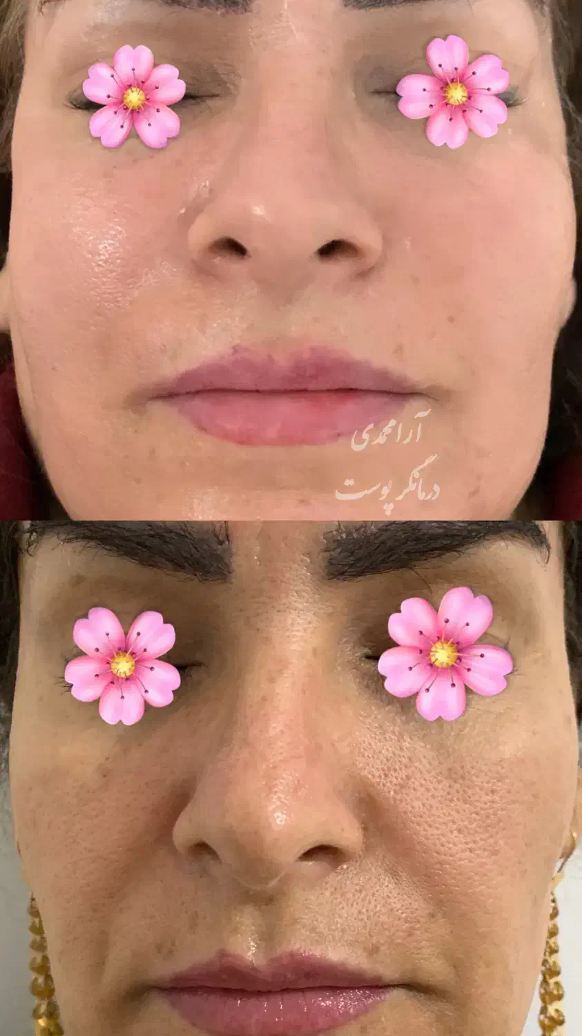 درمان پوست باتخفیف بلک فرایدی/پوست کره‌ای/کاموفلاژ|خدمات آرایشگری و زیبایی|پاکدشت, پاکدشت (مامازند)|دیوار