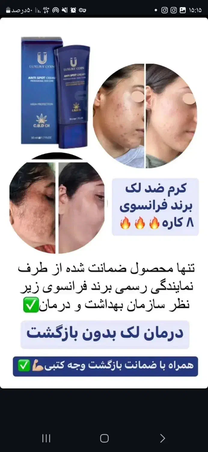 ضدلک لاکچری کوین بدون بازگشت بدون کورتون تضمینی|آرایشی، بهداشتی، درمانی|یاسوج, |دیوار