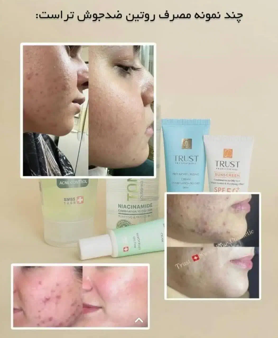 پوست خود را بامحصول تراست تجربه کنید  فاقد پارابن|آرایشی، بهداشتی، درمانی|تهران, سلسبیل جنوبی|دیوار