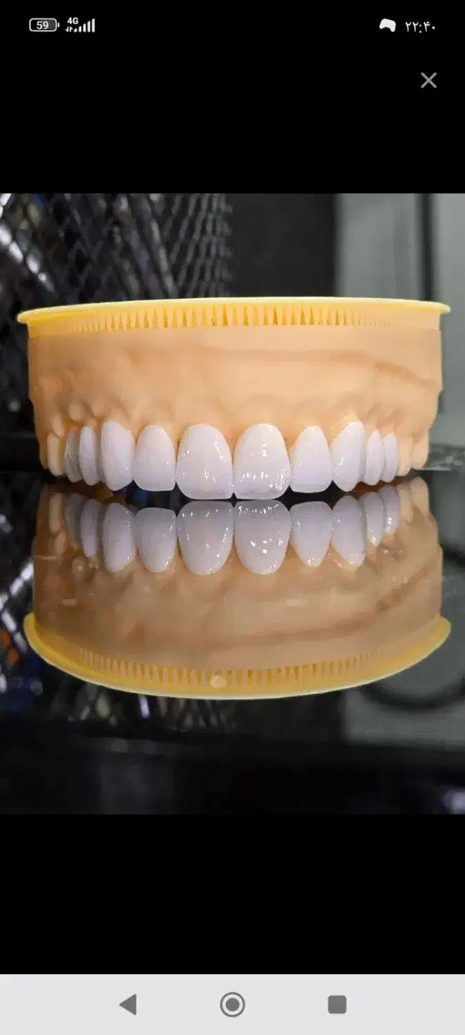 دندانسازی متحرک و ثابت|آرایشی، بهداشتی، درمانی|فردیس, شهرک ناز|دیوار