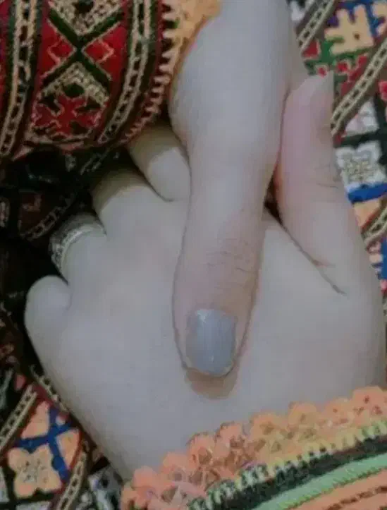 کرم سفید کننده صورت و دست وپا|آرایشی، بهداشتی، درمانی|ایرانشهر, |دیوار