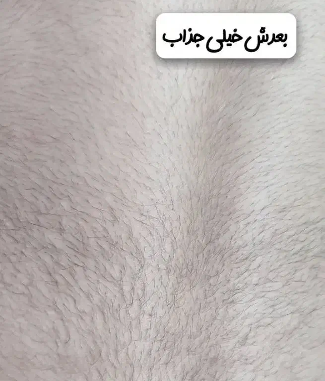 اپلاسیون فوق تخصصی کار باوکس|خدمات آرایشگری و زیبایی|شیراز, فضل‌آباد|دیوار