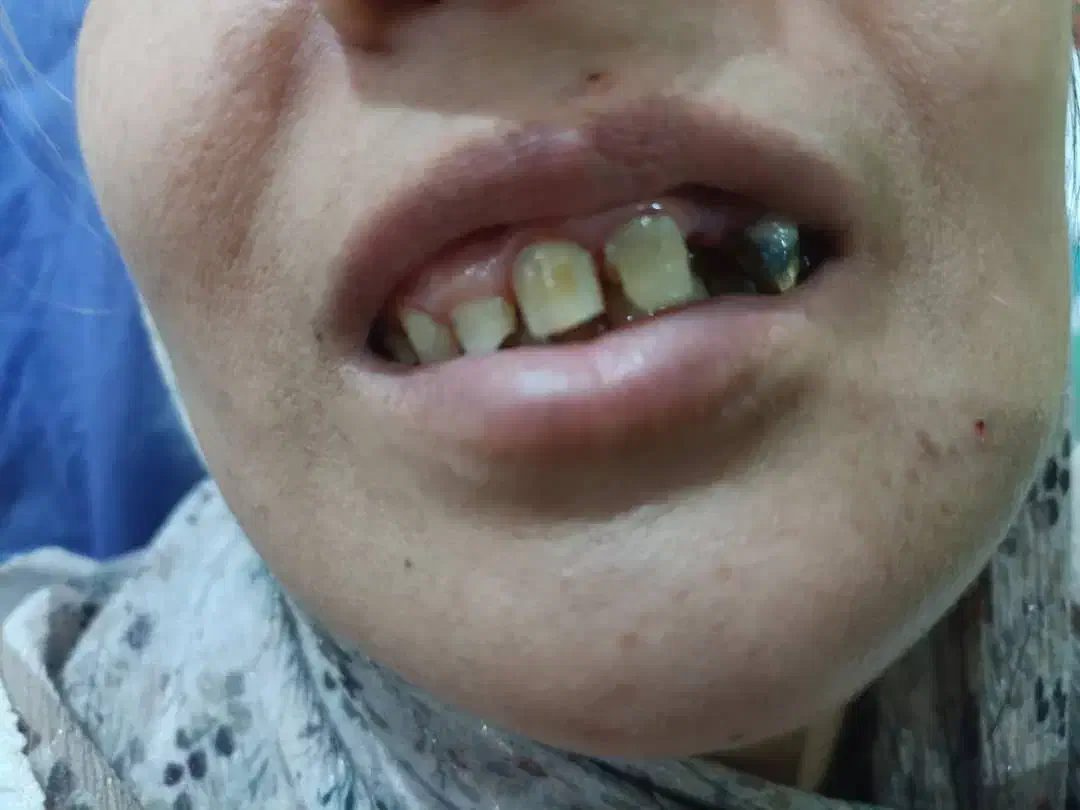 خدمات تخصصی دندانپزشکی تضمینی و اقساطی|خدمات آرایشگری و زیبایی|نیشابور, دارایی|دیوار