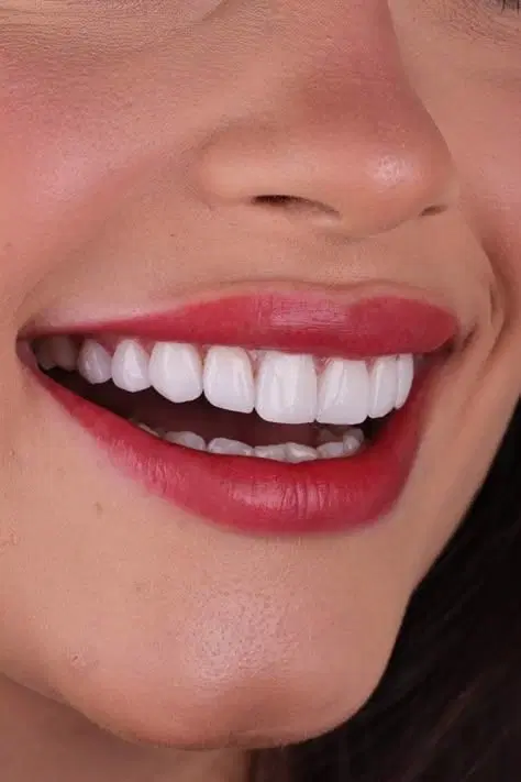 دندانپزشکی تخصصی تهرانپارس|خدمات زیبایی و سلامت|تهران, خاک سفید|دیوار