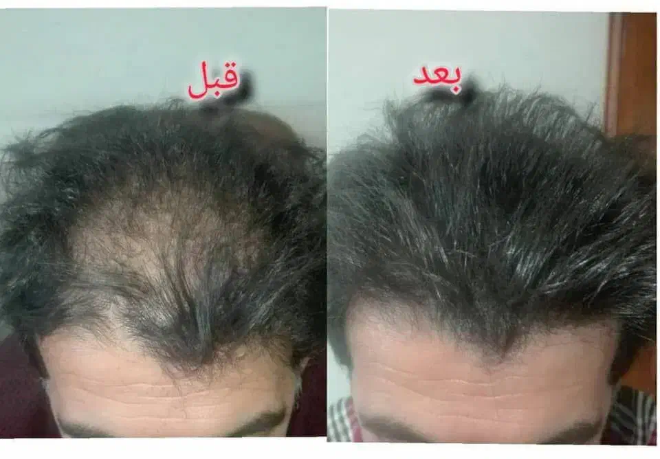 رویش طبیعی|آرایشی، بهداشتی، درمانی|نجف‌آباد, شهدای غربی|دیوار