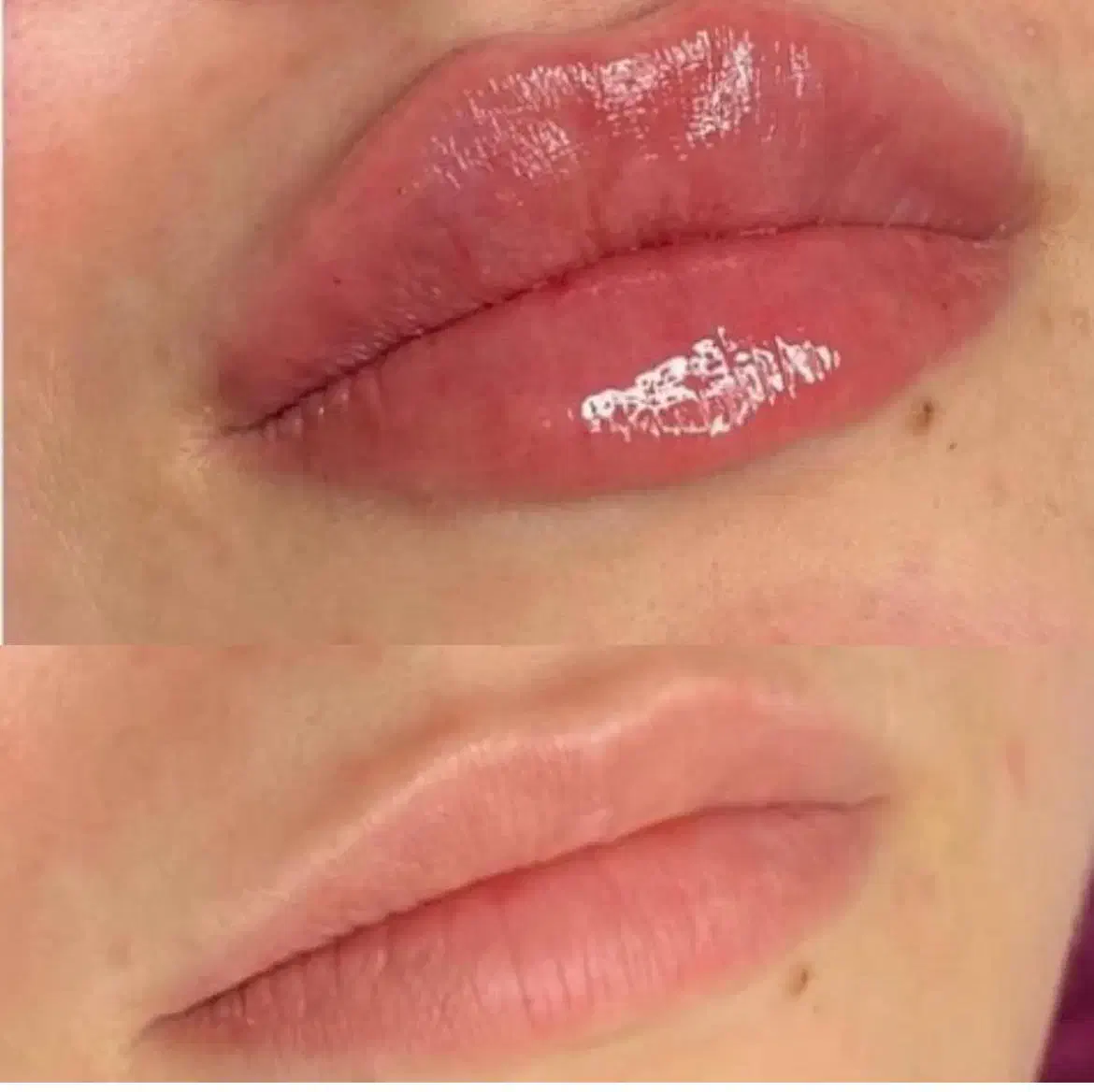 تخفیف ویژه دکتر شکری|خدمات آرایشگری و زیبایی|شاهین‌شهر, حافظ شمالی|دیوار