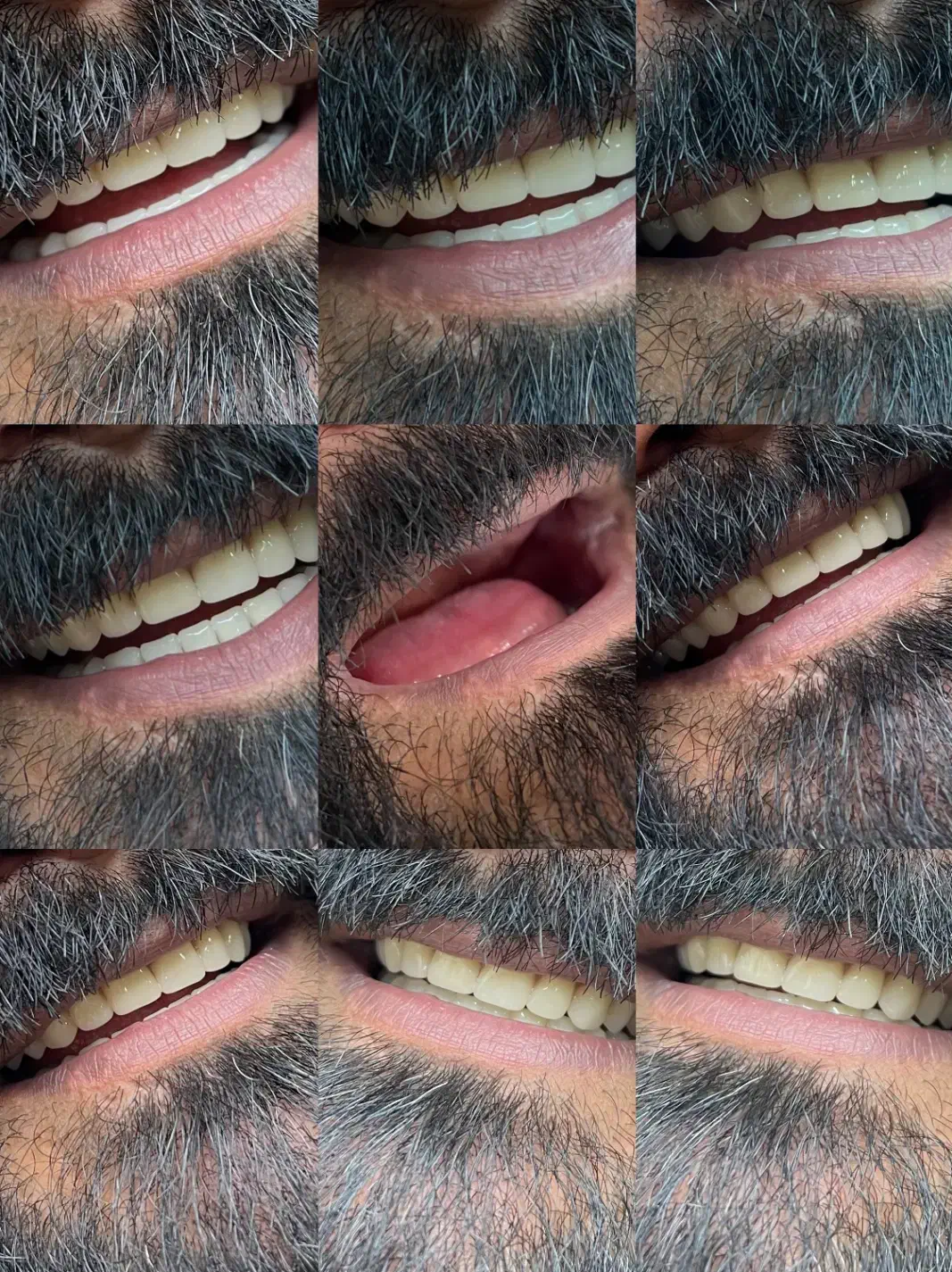 دندان مصنوعی|خدمات آرایشگری و زیبایی|پرند, فاز ۲|دیوار