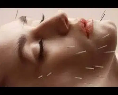 طب سوزنی (چینی)|خدمات آرایشگری و زیبایی|اهواز, فرهنگ شهر|دیوار