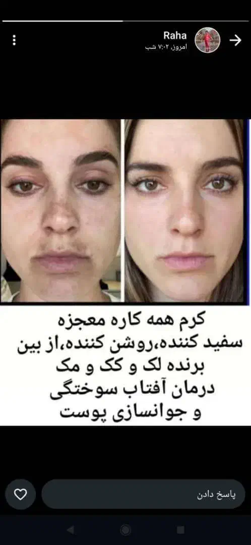 کرم معجزه 43ترکیبه عماراتی|آرایشی، بهداشتی، درمانی|شیراز, سلطان آباد|دیوار