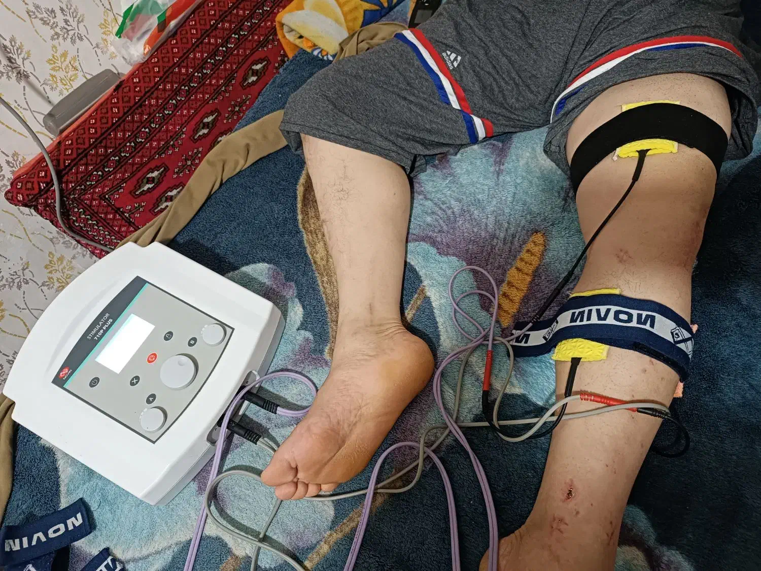 فیزیوتراپی کاردرمانی توانبخشی در منزل دکتر سلطانی|خدمات آرایشگری و زیبایی|سنندج, |دیوار