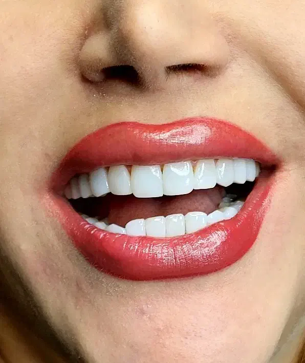 کامپوزیت زیبایی|خدمات آرایشگری و زیبایی|اسلامشهر, شهرک قائمیه|دیوار