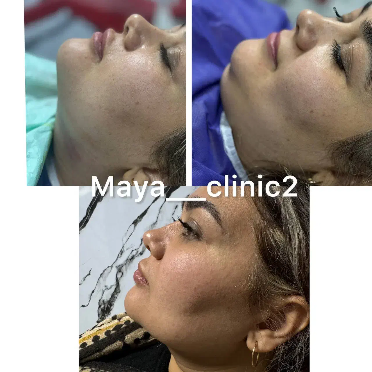 کلینیک زیبایی پوست و مو مایا|خدمات آرایشگری و زیبایی|ماهدشت, |دیوار