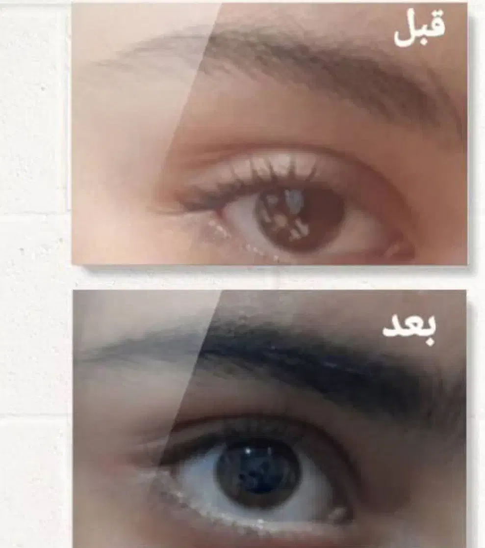 آیا علت ریزش مو را میدانید|آرایشی، بهداشتی، درمانی|جیرفت, |دیوار