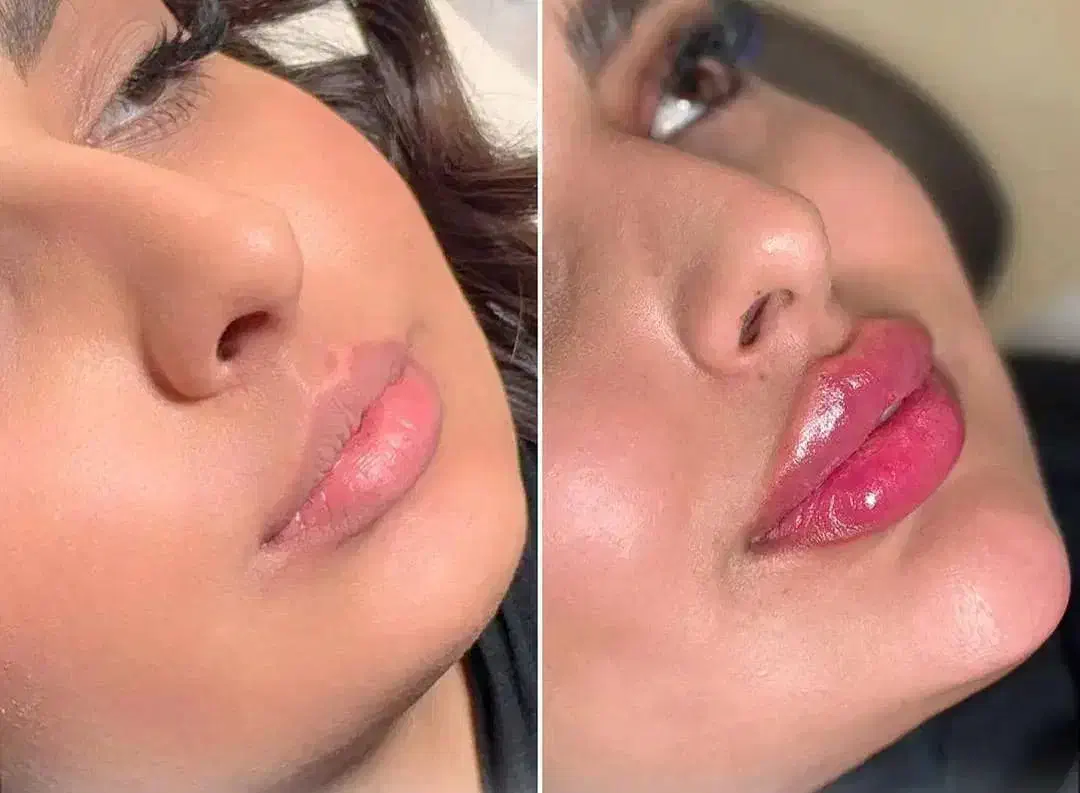 تخفیفات یلدایی ،مدل رایگان ،کلینیک دارای ۳شعبه|خدمات آرایشگری و زیبایی|شهریار, شهرک بهاران (ویره)|دیوار