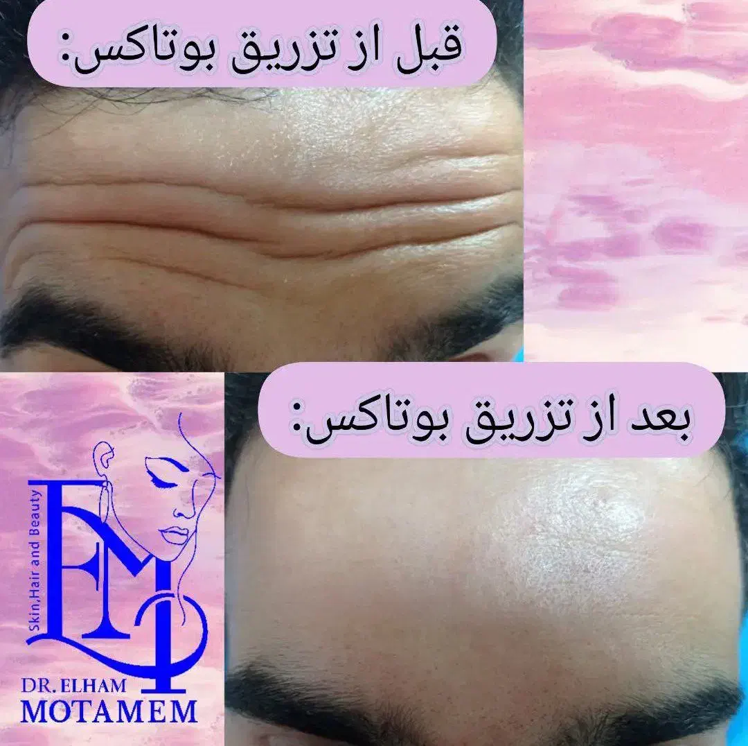 مطب پوست،مو،زیبایی دکتر الهام متمم|خدمات آرایشگری و زیبایی|رشت, گلسار|دیوار