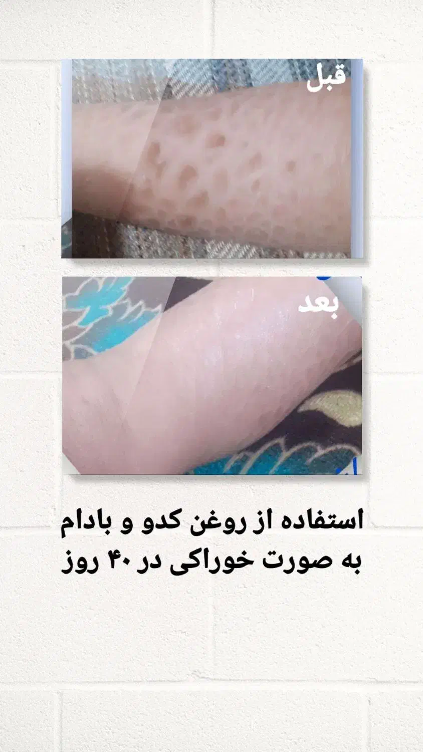 روغن های درمانی صددرصد خالص|حراج|کرج, دانشگاه هنر تهران (پردیس کرج)|دیوار