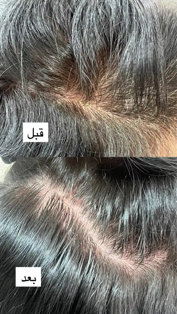 اسکراب و پاکسازی تخصصی کف سر /درخشش و رشد مو|خدمات آرایشگری و زیبایی|صدرا-فارس, فاز ۱|دیوار