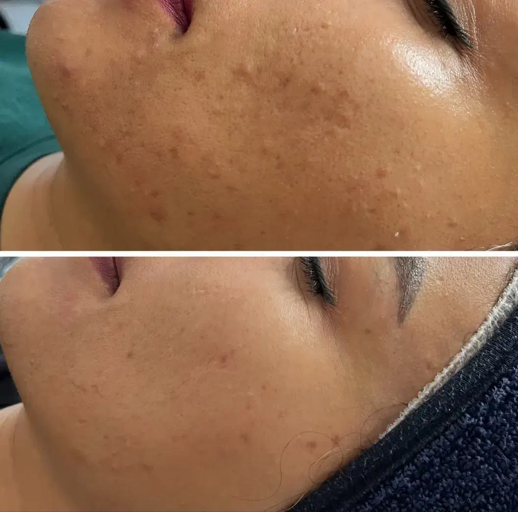 تخفیف ویژه پاکساژی و ماساژ صورت|خدمات آرایشگری و زیبایی|سقز, |دیوار