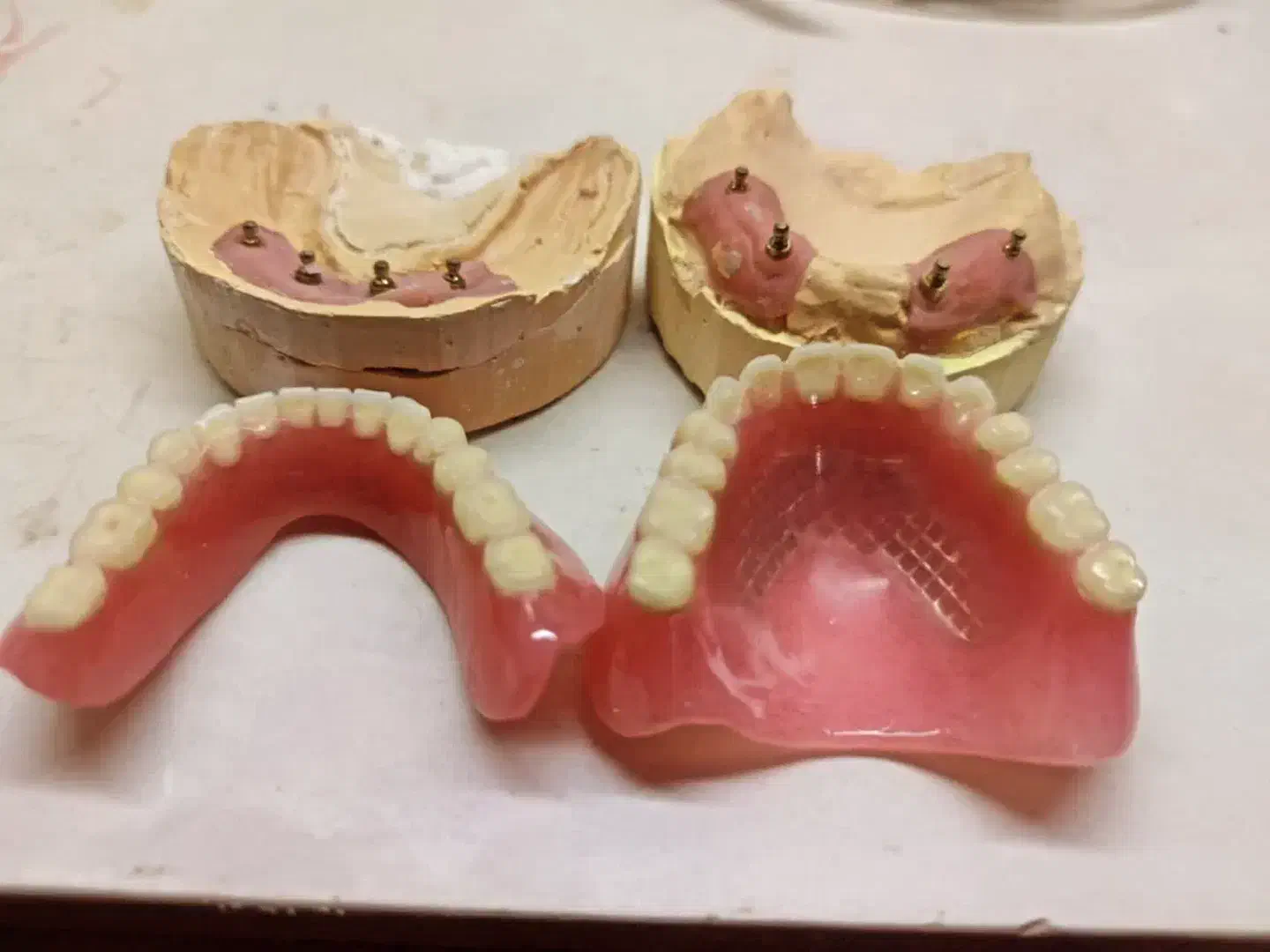 دندان سازی (اقساطی)|خدمات آرایشگری و زیبایی|قم, چهار مردان|دیوار