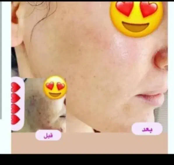 کرم بدن نقره|آرایشی، بهداشتی، درمانی|خاش, |دیوار