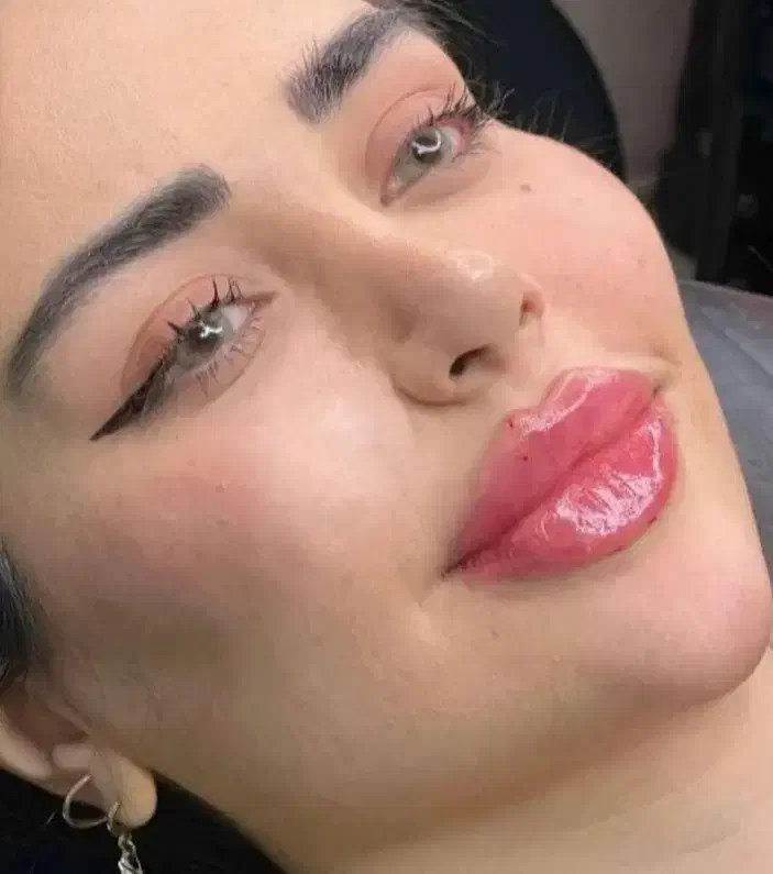 جشنواره پاییزی ژل و بوتاکس توسط پزشک|خدمات آرایشگری و زیبایی|کرمانشاه, |دیوار