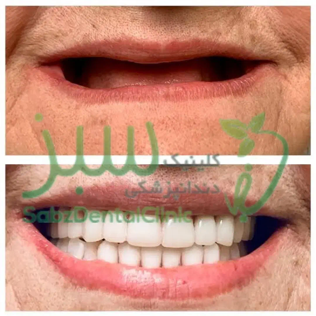 کلینیک دندانپزشکی لبخند سبز (ساخت دندان مصنوعی)|پزشکی|همدان, |دیوار