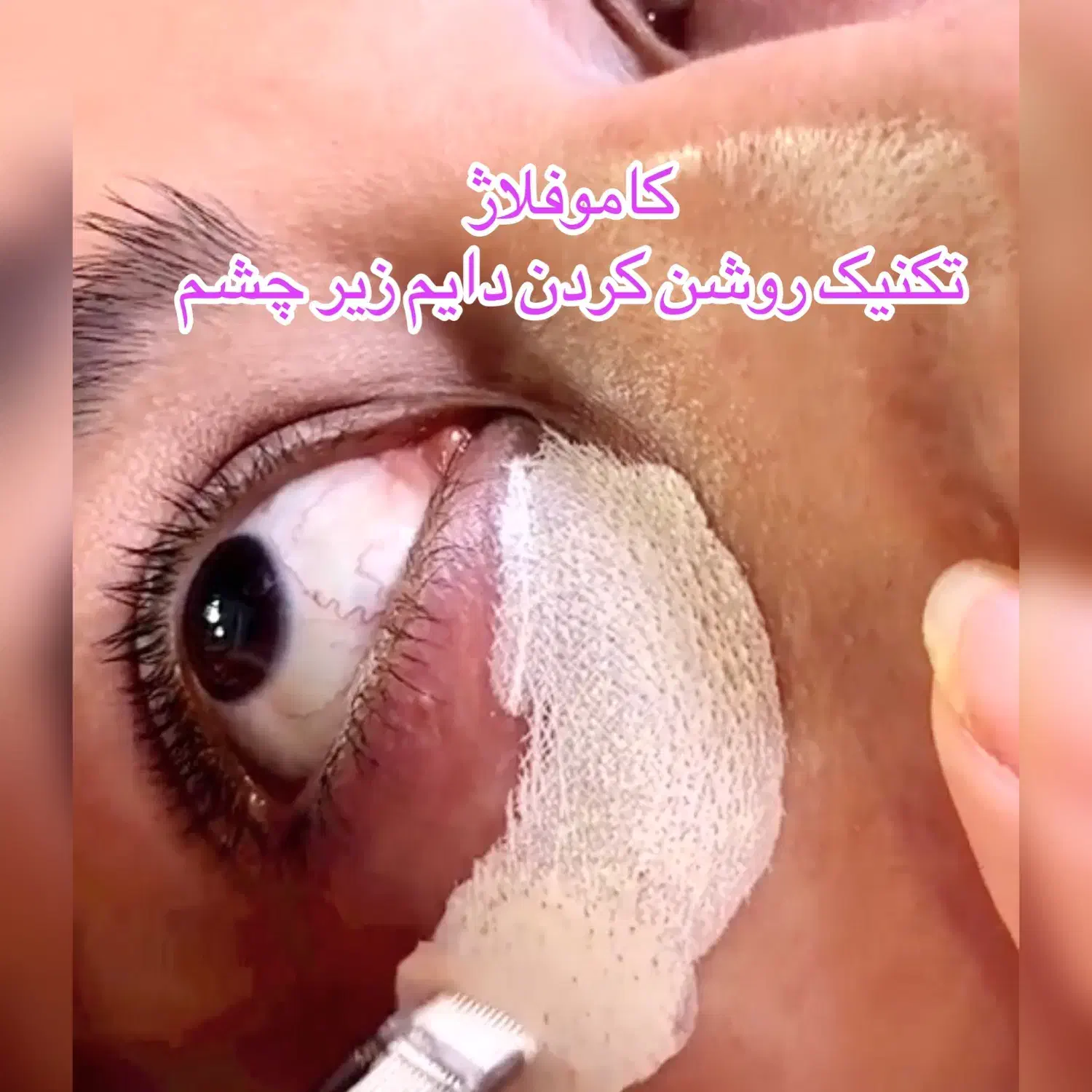 کاموفلاژ رفع تیرگی قطعی زیرچشم و لک|خدمات آرایشگری و زیبایی|تهران, شکوفه (عبدل آباد)|دیوار