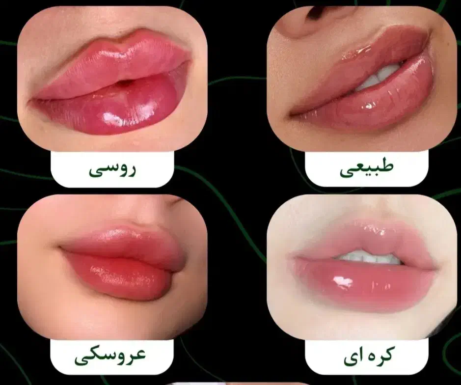 ارزانسرای تخصصی تزریق ژل و بوتاکس|خدمات آرایشگری و زیبایی|مسجد سلیمان, |دیوار