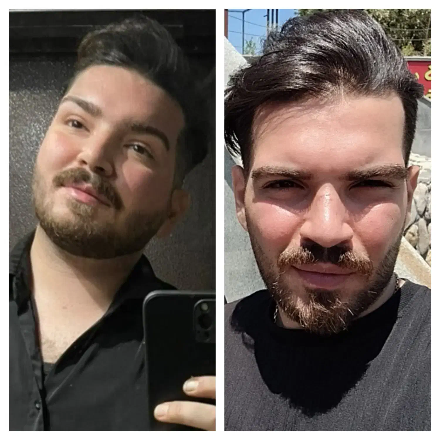 چاقی صورت و بدن|آرایشی، بهداشتی، درمانی|اهواز, کیان اباد|دیوار