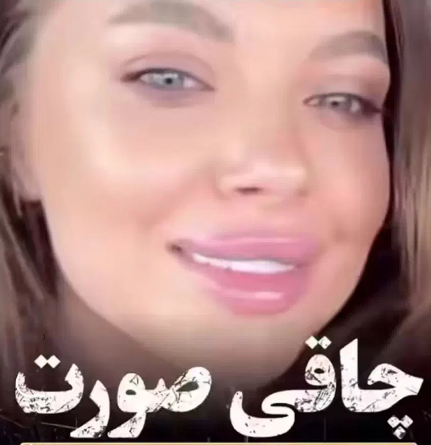 چاقی صورت|آرایشی، بهداشتی، درمانی|اهواز, کیان اباد|دیوار