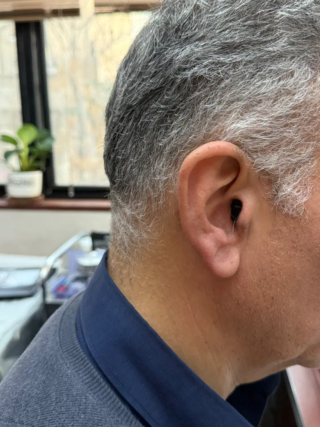 سمعک برتر|پزشکی|تهران, زرگنده|دیوار