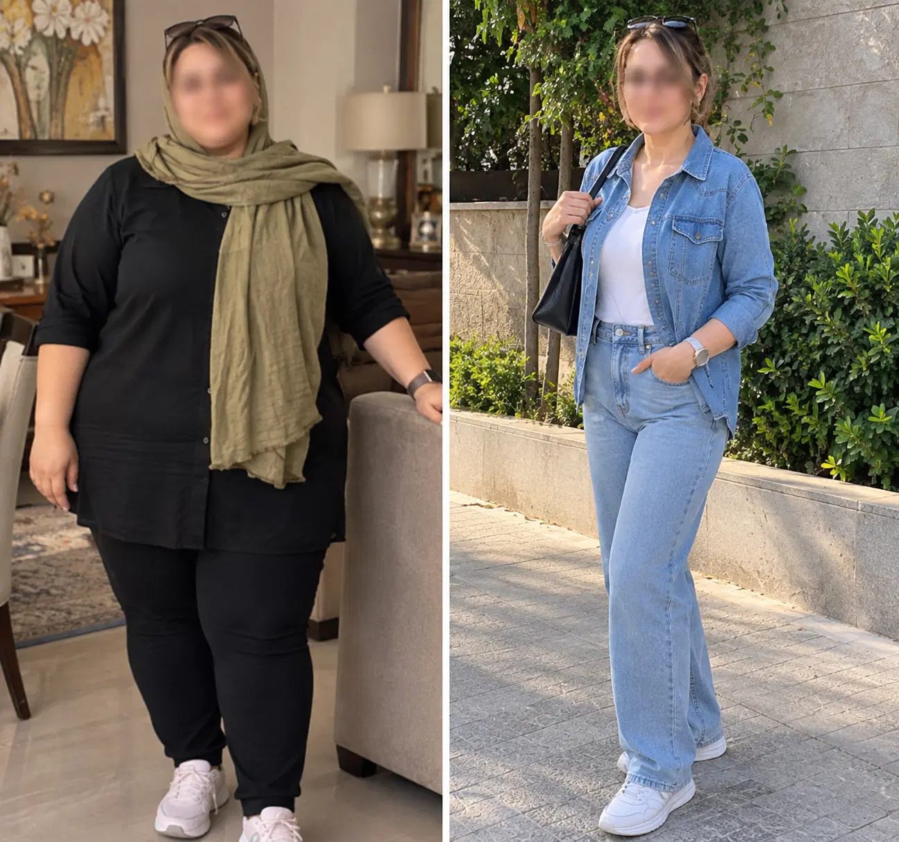 جشنواره پایان فصل اسلیو بایپس لیپوابدو مامو لیفت|خدمات زیبایی و سلامت|تهران, جماران (نیاوران)|دیوار