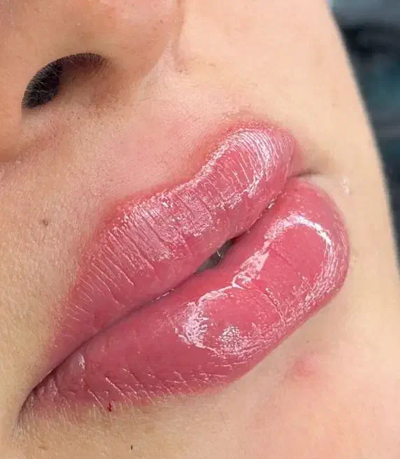 اف یلدایی خدمات ژل و بوتاکس|خدمات آرایشگری و زیبایی|آبادان, |دیوار