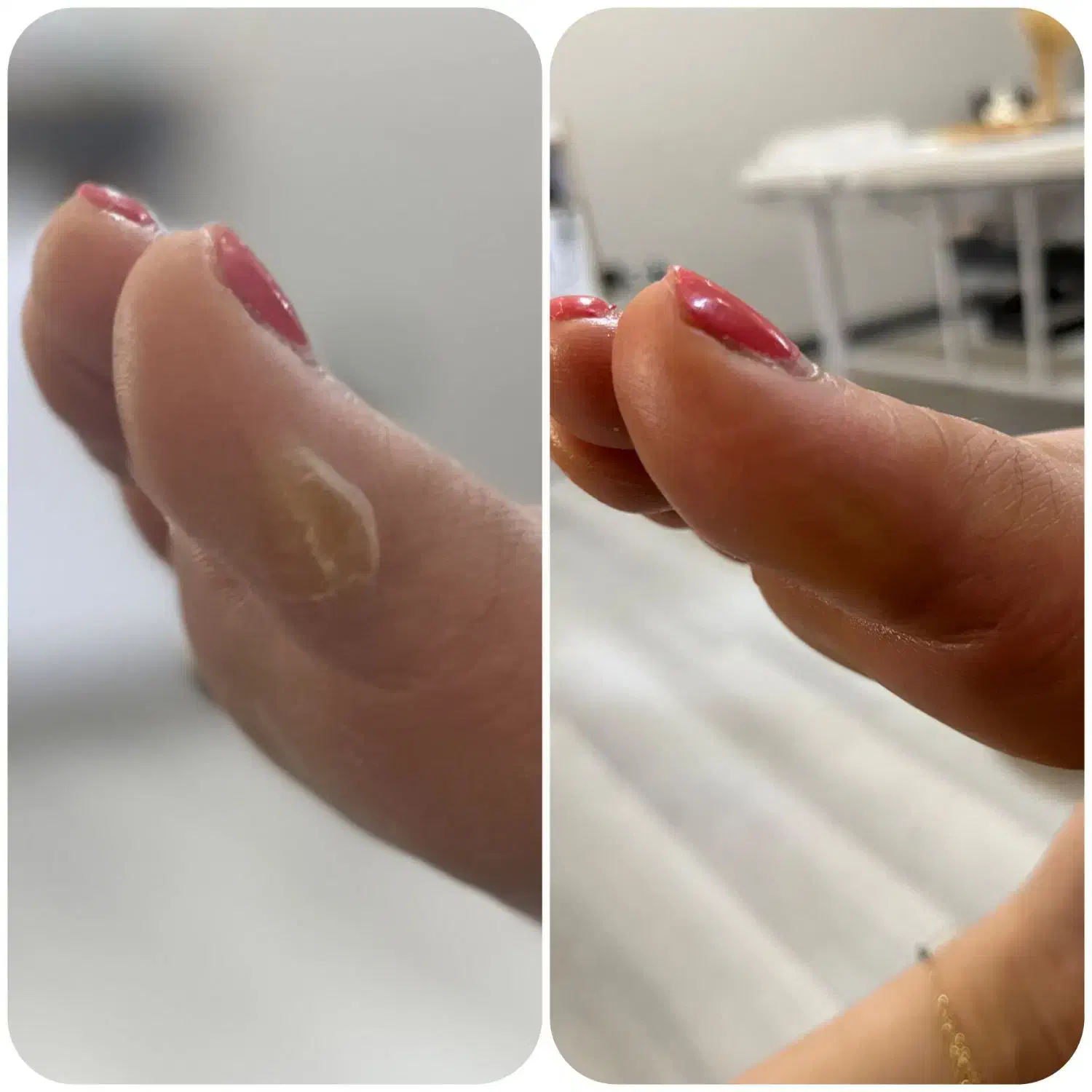 پدیکور با قیمتی مناسب|خدمات آرایشگری و زیبایی|رشت, معلم|دیوار