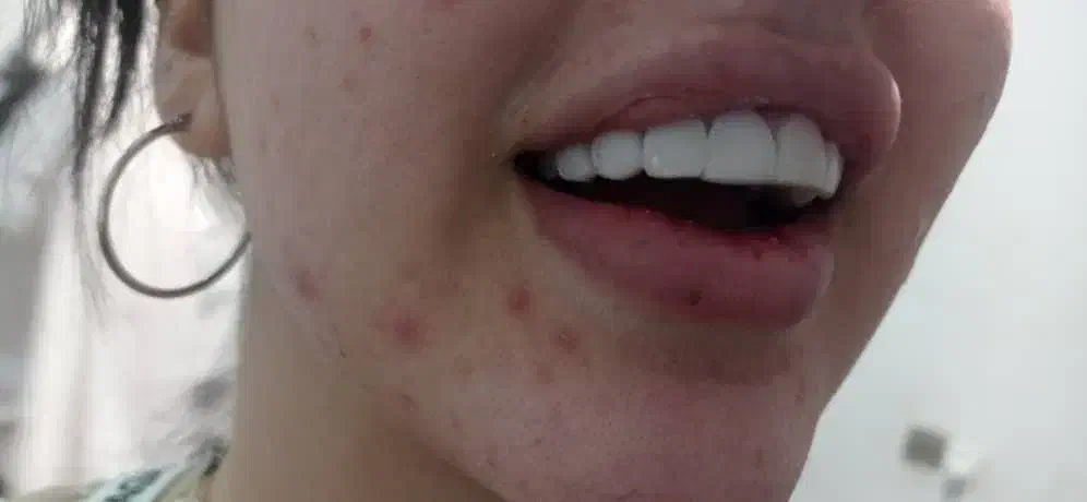 تخفیفات ویژه کامپوزیت در درمانگاه تخصصی یاسوج|خدمات آرایشگری و زیبایی|یاسوج, |دیوار