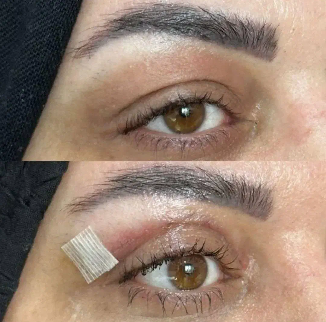 آموزش بلفاروپلاستی لیزری|خدمات آموزشی|تهران, ونک|دیوار