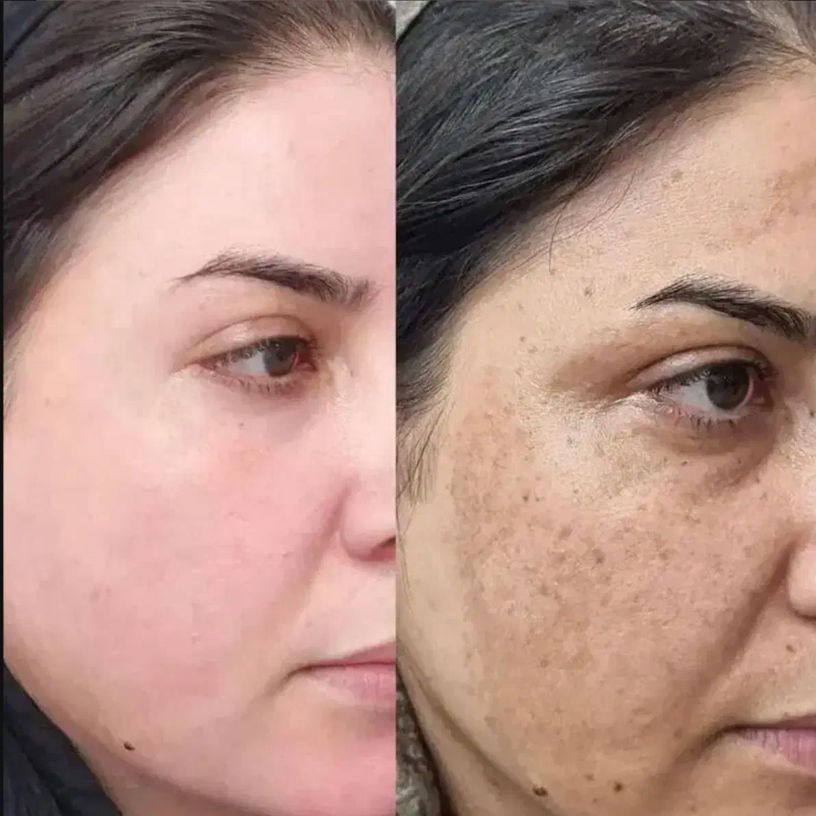 کرم روشن کننده|آرایشی، بهداشتی، درمانی|باشت, |دیوار